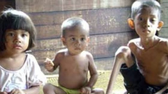 Tangani Stunting, Pemkab Bekasi Fokuskan Gizi Ibu Hamil dan Balita