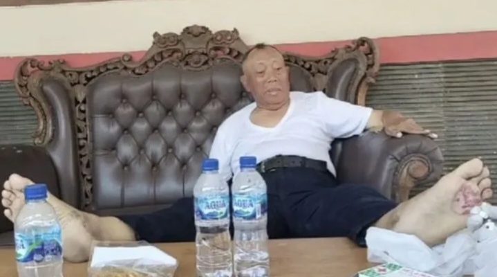 Perjalanan Yogya-Jabar Terhenti, Komaruddin Alami Pendarahan di Tapak Kaki